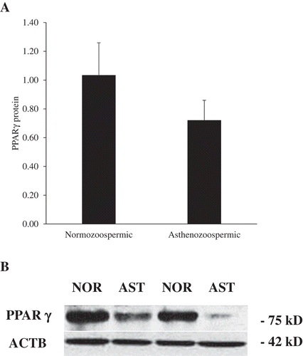 Figure 3. PPARγ protein expression in human spermatozoa based on western blot analysis. (A) PPARγ protein content in normozoospermic (n = 7) and asthenozoospermic (n = 8) men based on western blot analysis (mean±SEM), (P > 0.05). As seen using flow cytometry (Figure 2), western bolt analysis revealed that level of PPARγ protein tended to be higher in normozoospermic than asthenozoospermic men (P = 0.089). (B) Western blot detection of PPARγ protein in four samples of ejaculated spermatozoa (two normozoospermic = NOR and two asthenozoospermic = AST). ACTB was used as a loading control.