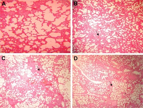 Figure 6 Histopathological effects of GONs on the lung of rats after 21 days. Representative photomicrograph of (A) control group (H&E, ×100), (B) Rats receiving 50 mg/kg of GONs (H&E, ×40), (C) Rats receiving 150 mg/kg of GONs (H&E, ×40), and (D) Rats receiving 500 mg/kg of GONs (H&E, ×40).Note: small black arrows indicate alveolar wall thickening.Abbreviations: GONs, graphene oxide nanoplatelets; H&E, hematoxylin and eosin.