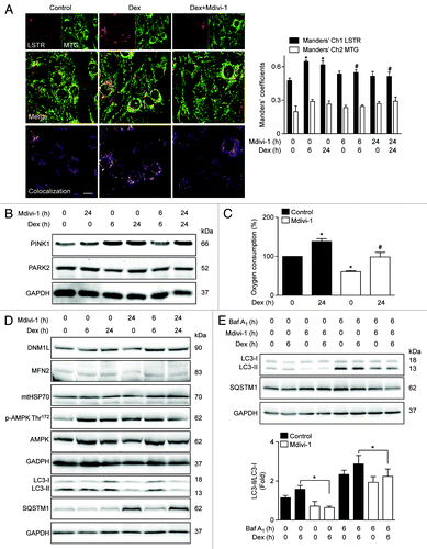 Figure 6. Mitochondria (MTG) and lysosome (LSTR) colocalization shown by confocal microscopy in control, Dex. and Dex plus Mdivi-1 (DNM1L inhibition) incubated L6 myoblast, quantification of mitochondria and lysosome colocalization expressed by Manders’ coefficient in L6 myoblast incubated with Dex and/or Mdivi-1 for 0, 6, and 24 h (A). Western blot analysis of PINK1, PARK2, and GAPDH in L6 myotubes incubated with Dex and/or Mdivi-1 for 0, 6, and 24 h (B). Oxygen consumption of Dex and/or Mdivi-1 incubated L6 myotubes (C). Western blot analysis of DNM1L, MFN2, mtHSP70, phophorylated AMPK, total AMPK, LC3, SQSTM1, and GAPDH in Dex and/or Mdivi-1 incubated L6 myotubes (D). Western blot analysis of LC3, SQSTM1 and GAPDH in Dex, Mdivi-1, and/or Baf A1 treated L6 myotubes (E). Data: mean ± SEM of at least 3 independent experiments. Statistically significant differences were calculated using ANOVA in combination with a Tukey test for group comparison. *P < 0.05 vs. control, #P < 0.05 vs. Dex.