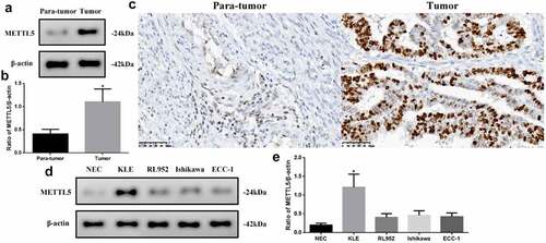 Figure 2. METTL5 levels in different UCEC tissues or cell lines. (a) METTL5 expression in para-tumor and tumor tissues by Western blot. (b) Western blot quantification, and (c) IHC for METTL5 (×400). (d) METTL5 expression in NEC, KLE, RL952, Ishikawa, and ECC-1 cells. (e) METTL5 quantification. Protein levels were normalized to β-actin. (Tumor vs. Para-tumor, KLE vs. other cells, *P < 0.05, n = 6 per group).