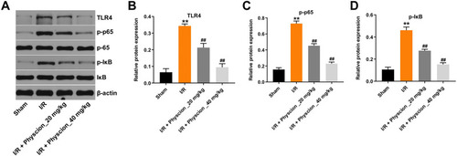 Figure 6 Physcion protects rats against brain damage after I/R via inhibiting the TLR4/p65 pathway. (A) Expression levels of TLR4, p-p65, p-IκB in the whole brain tissues of I/R rats were detected with Western blotting. (B–D) The relative expressions of TLR4, p-p65, p-IκB in the whole brain tissues of I/R rats were quantified via normalization to β-actin, p65 and IκB. **P<0.01 compared with sham group; ##P<0.01 compared with I/R group.