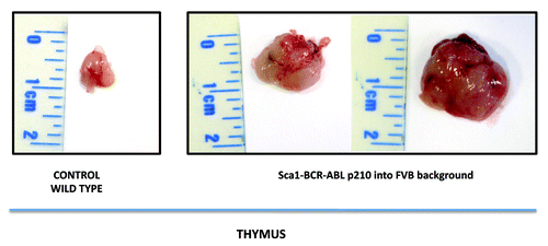 Figure 1. Macroscopic appearance of the thymus in Sca1-BCRABLp210 mice in FVB background. Sca1-BCRABLp210 mice in FVB background with signs of disease were analyzed and the thymus was surgically removed. Macroscopically there was sign of thymoma. A thymus of an aged wild-type mouse is shown as a control.