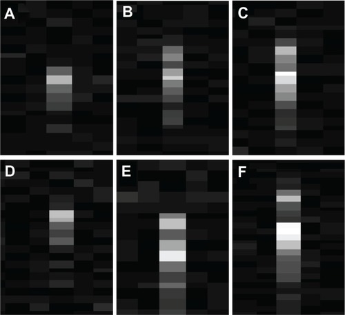 Figure 11 (A–F) Sample echographic images of “optoacoustic spots” detected during laser irradiation at 30 mJ/cm2 of gold nanorod (GNR) solutions of variable volume and concentration. (A) GNR concentration = 25 pM, sample volume = 100 μL; (B) GNR concentration = 50 pM, sample volume = 100 μL; (C) GNR concentration = 200 pM, sample volume = 100 μL; (D) GNR concentration = 100 pM, sample volume = 50 μL; (E) GNR concentration = 100 pM, sample volume = 100 μL; (F) GNR concentration = 100 pM, sample volume = 200 μL.
