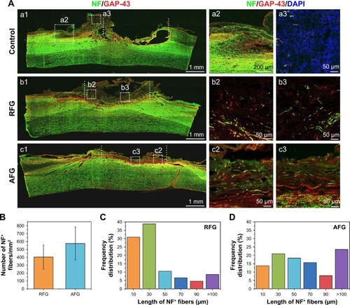 Figure 4 Nerve regeneration in the dorsal hemisected site at 8 weeks after surgery. Shown in Figure 5A, (a1–c1) are the immunofluorescence staining images of T8–T10 sagittal sections with NF (green), GAP43 (red), and DAPI (blue). Higher magnification images of the areas circled by the dotted white squares in the left images are shown in the right columns ([a2–a3], [b2–b3] and [c2–c3], respectively). The quantification of NF-positive fibers at the injury site is shown in (B), (C), and (D): (B) the density of NF-positive fibers at the injury site; the frequency distribution of NF-positive fibers of RFG (C) and AFG (D). Four individual rats per group were used for statistical analysis (n = 4), and five confocal images per rats were used for the NF-positive fiber counts and length calculation.Abbreviations: AFG, aligned fibrin hydrogel; DAPI, 4′,6-diamidino-2-phenylindole; NF, neurofilament; RFG, random fibrin hydrogel.