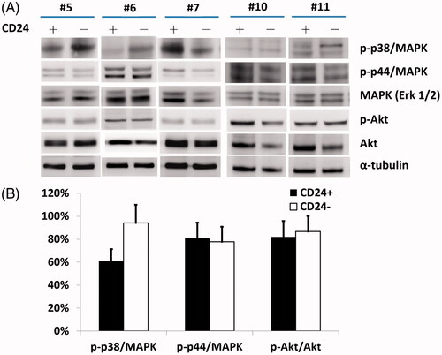 Figure 5. (A) A higher level of p-p38 MAPK with significant difference (B) was noted in CD24– cells compared to CD24+ cells (lane 1). However, there were no substantial changes in the levels of either p-p44/42 MAPK or total MAPK (Erk1/2) proteins (lanes 2 and 3).