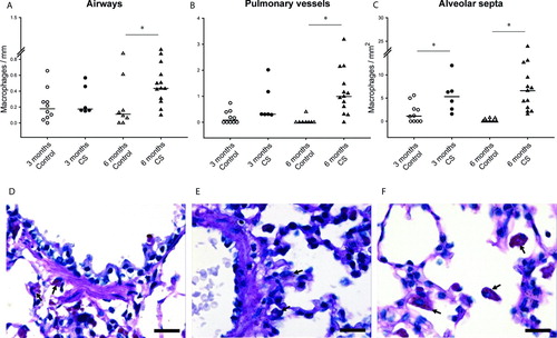 Figure 2.  Macrophage infiltration in the lungs of guinea pigs. Individual count for macrophages in the airways (A), pulmonary vessels (B) and alveolar septa (C) of controls and CS-exposed animals. Results are expressed as number of cells normalized by Pil in airways, Pim in vessels or square millimeter in alveolar septa. Horizontal bars represent median values. * p ≤ 0.05 CS-exposed vs. Control (Mann-Whitney rank sum test). Photomicrographs of an airway (D), a pulmonary vessel (E) and alveolar septa (F) of guinea pigs exposed to CS (PAS stain. Scale bar, 20 mm). Arrows show infiltrating macrophages.