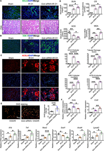 Figure 4 Targeted Gclc exacerbated IR induced AKI. (A) Immunofluorescence staining of GCLC, as well as PAS staining, and their corresponding scoring in the Sham, IR D1, and Gclc siRNA+IR D1 groups (n = 4–5 per group). Scale bar, 20 μm. (B) Immunofluorescence staining and scoring of KIM-1 in Sham, IR D1, and Gclc siRNA+IR D1 groups (n = 4–5 per group). Scale bar, 20 μm. (C) Immunofluorescence staining and scoring of ACSL4 in Sham, IR D1, and Gclc siRNA+IR D1 groups (n = 5 per group). Scale bar, 20 μm. (D) Detection of BUN and CR, as well as serum SOD and MDA in Sham, IR D1, and Gclc siRNA+IR D1 groups (n = 4–5 per group). (E) Dihydroethidium (DHE) staining and scoring of oxygen glucose deprivation/reoxygenation (OGD/R) and Gclc siRNA+ OGD/R groups in primary renal tubular epithelial cells (n = 5–6 per group). Scale bar, 50 μm. (F) The levels of Gclc, inflammation-related factors (Ccl2, Il1b, and Tnf), oxidative stress-related indicators (Nox2 and Sod1), and ferroptosis-related indicators (Acsl4 and Lpcat2) were measured using RT-qPCR. *P < 0.05, **P < 0.01, ***P < 0.001 as determined by one-way ANOVA. Data represent mean ± SEM.