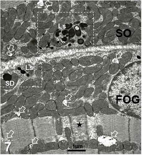 Figure 7. Ls and a single spherical deposit deposit in both SO and FOG fibers of an adult female obese Zucker rat (surrounded by broken rectangles whose enlarged views are displayed in (Figures 8(a) and 10(a-b)). Both fiber types contained mitochondria aggregates with a few degraded as marked with open arrows