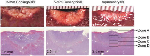 Figure 8. Comparison between macroscopic (top) and microscopic (bottom) samples from the in vivo coagulation zones created with the 3-mm Coolingbis®, 5-mm Coolingbis® and Aquamantys® devices in spot mode.