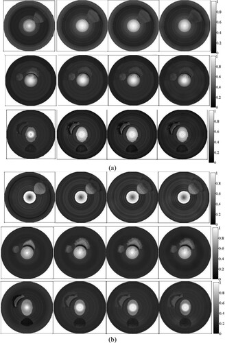 Figure 13. Images obtained with the proposed method and the fixed SoS method. In each subfigure, the top, middle and bottom row present the results of the vessel phantom a, b and c respectively. In each row, from left to right, the image is obtained by using the proposed method, fixed SoS of 1540, 1570, and 1600 m/s respectively. (a) AOED; (b) OAC.