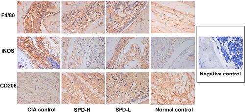 Figure 4 Immunohistochemical results of the ankle synovial tissue in each group (SP×400).
