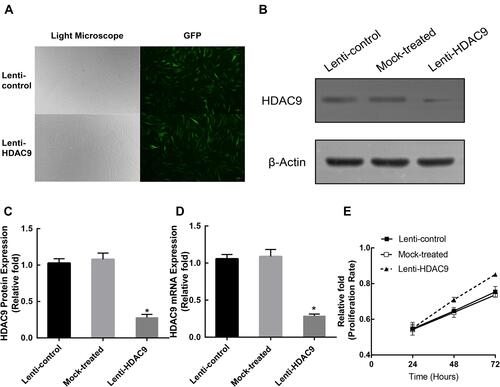 Figure 1 Construction of HDAC9-knockdown hBMSCs and lenti-control hBMSCs. (A) hBMSCs after lentiviral transfection and puromycin screening were observed under a normal microscope and a fluorescence microscope. Scale bar =10μm. (B–D) The protein and mRNA levels of HDAC9 were determined by Western blotting and qRT-PCR analysis, respectively, in the lenti-HDAC9, lenti-control, and mock-treated groups. (E) The proliferation rate of hBMSCs was not significantly affected by HDAC9 knockdown. The data are expressed as the means ± S.D. *P<0.05 versus the lenti-control group.