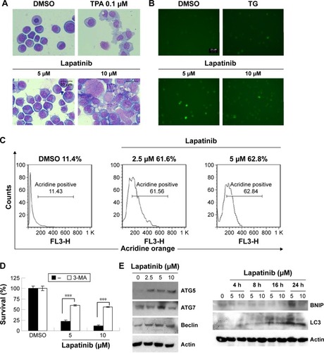 Figure 3 The induction of autophagic cell death by lapatinib in U937 cells.