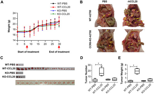 Figure 5 CCL20-CCR6 axis promotes ovarian cancer metastasis in vivo.