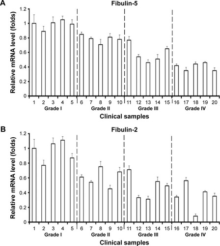 Figure 6 The mRNA level of fibulin-2 and fibulin-5 in clinical specimens.