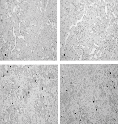 Figure 5. (A) No expression of HIF-1α in the sham-control group rats; (B) HIF-1α-positive immunostaining mildly detected in the group 2 animals (arrows); (C) HIF-1α expression by intensity in the tubulus epithelia and the interstitial spaces from I-R/ L-Arg group rats (arrows).