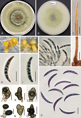 Figure 8. Colletotrichum sublineola (from strain UTFC 381). A–B. Colony on OA after 7 d, A. upper and B. reverse side. C. Tip of a seta. D, E. Acervuli. F. Conidiophores. G. Base of a seta. H, I, P. Conidia. J–O. Appressoria. C, G–I. from Anthriscus stem. D–F, J–P. from SNA. D, E. DM. C, F–P. DIC. Scale bars: D–E = 50 μm, C, F–P = 10 μm.