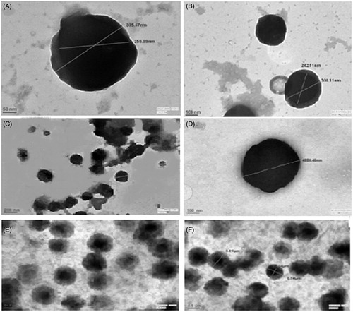 Figure 4. TEM image of trehalose and cellobiose coated nanocores (TNC and CNC) followed by catalase adsorption on both core(ETNC and ECNC) and its nanoencapsulation within alginate polymer (AETNC and AECNC) (A) TNC, (B) CNC, (C) ETNC, (D) ECNC, (E) AETNC, (F) AECNC.