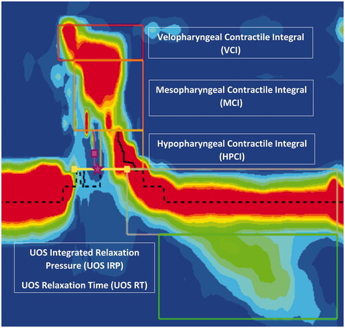 Figure 1. Pharyngeal and upper oesophageal sphincter (UOS) metrics.