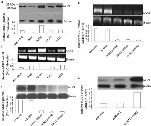 Figure 1. Effect of shRNA or plasmid transfection on MUC1 expression in LSCC cells. (a) MUC1 protein expression was detected in Hep2, TU-212, TU686, TU177 and AMC-HN-8 cells by Western blot assay; (b) MUC1 mRNA was detected in Hep2, TU-212, TU686, TU177 and AMC-HN-8 cells by RT-PCR assay; (c) TU686 cells were transfected into MUC1 shRNA 1, 2, and 3 for 72 h, MUC1 protein expression was detected by Western blot assay; (d) MUC1 mRNA expression was detected by RT-PCR assay; E, Hep2 cells were transfected into pcDNA3.1 or pcDNA3.1 MUC1 for 72 h, MUC1 protein expression was detected by Western blot assay. vs untreated.**P < 0.01.