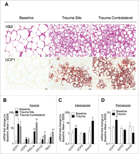 Figure 2. Trauma induces distant browning. (A, upper panel) Representative H&E stained inguinal fat from baseline and one day post trauma (site and contralateral). Trauma site and contralateral showed reduce lipid droplets to form packed multilocular adipocytes. (A, lower panel) Immunostaining using antibody against UCP1 showed protein expression in the traumatized (trauma Site) and contralateral adipose tissue. (B-D) Q-PCR against UCP1, UCP2, PGC1α, CD137 and TBX1 gene in the inguinal adipose depot (B) and against UCP1, UCP2 and Elovl3 gene in the interscapular (C) and perivascular fat depot (D) at baseline and one day after left inguinal trauma (trauma site and contralateral). Expression values were normalized to their respective baseline. Data are mean±SEM of 5–6 independent animals per group. Bars represent 20 μm. *p < 0.05, **p < 0.01, ***p < 0.001 vs. baseline.