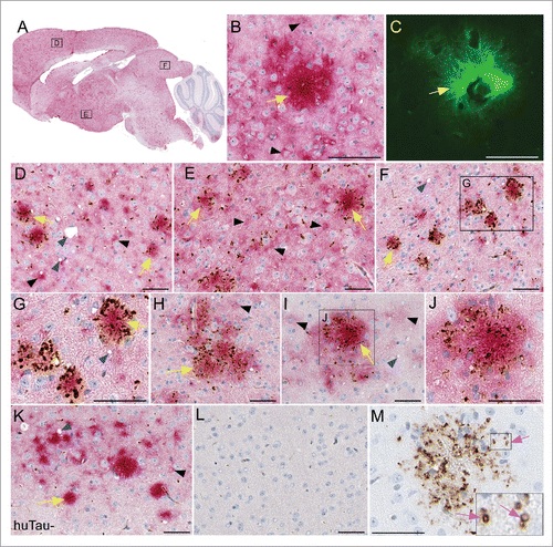 FIGURE 4. Immunohistochemical analysis of PrPSc deposition and association with human tau in transgenic mouse brains. All brain tissues from scrapie-infected mice were obtained at the time of clinical disease. (A-G) Representative sections from a RML scrapie-infected huTau+ mouse and (H-J) 22L scrapie-infected huTau+ mouse are shown. (A) Whole brain sagittal section demonstrating widespread PrPSc staining with D13 (red) and boxes depicting areas enlarged in D-F. (B, C) PrPSc plaque stained with D13 and Thioflavin S respectively. (D-J) Dual staining of PrPSc with D13 (red) and P-tau using anti-P-tau antibody CP13 (brown). A clear association of P-tau aggregates can be seen around PrPSc plaques (yellow arrows) in several regions of the brain including (D) frontal dorsal cortex, (E) hypothalamus, (F,G,H) colliculus, and (I,J) dorsal cortex. Non-amyloid PrPSc (black arrowheads) rarely had P-tau staining nearby. Scrapie-associated vacuoles (blue arrowheads) could be seen in some brain regions. (K) Minimal P-tau staining by CP13 in cortex of 22L scrapie-infected huTau− mouse. (L) Absence of D13 and CP13 staining in an uninfected huTau+ mouse. (M) PrPSc amyloid plaque from a huTau+ 22L scrapie-infected mouse stained with CP13. Note, without D13 staining the localization of P-tau in ring-like structures (pink arrows) is more obvious. The scale bar in each panel is 50 µm.