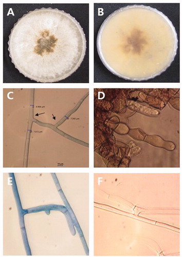 Figure 2. Microscopic and macroscopic characteristics of Rhizoctonia solani. (A–B) Colony with dark brown sclerotia grown on PDA. (C) Right-angle branching of septate hyphae. (D) Monilioid cells of sclerotia. (E–F) Hyphal anastomosis between a R. solani isolate for anastomosis group designation.