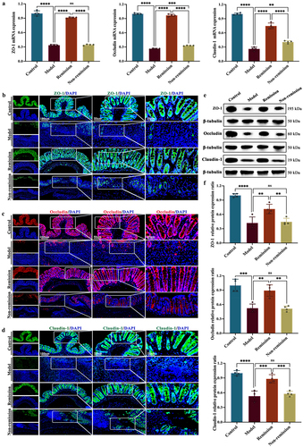 Figure 3. The gut barrier function in remission-achieving colitis mice is restored by anti-α4β7-integrin. (a) RT-qPCR of tight junction (TJ) proteins in colon (n = 4); (b) Representative images at scale bars of 100, 50, and 20 μm display TJ proteins immunofluorescence-stained colon tissue (n = 4); (c) Representative immunoblots of TJ proteins in colon (n = 4). Mean ± SD are presented. A one-way ANOVA was applied. nsp > .05, **p < .01, ***p < .001, and ****p < .0001.