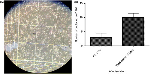 Figure 1. (A) Isolated CD133 + cells at day 0 counted by Haemocytometer. (B). Comparison of total number of MNC and CD 133+ after isolation.