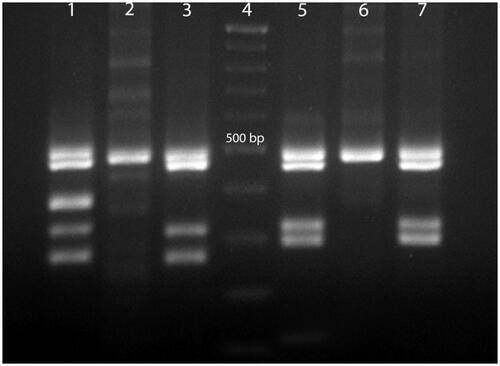 Figure 3. Multiplex PCR from normal man, woman and NOA patients with AZFc microdeletions. Line 1, normal men, multiplex 1; line 2, normal woman, multiplex 1; line 3, NOA patient with AZFc microdeletions in sY254 region, multiplex1; line 4, Gene RulerTM (DNA Ladder,100 bp, Fermentase # SM0333); line 5, normal men, multiplex 2; line 6, normal woman, multiplex 2; line 7, NOA patient with AZFc microdeletions in sY255 region, multiplex 2. Multiplex 1 included SRY: 427 bp, sY254: 400 bp (AZFc), sY86: 320 bp (AZFa), sY127: 274 bp (AZF b). Multiplex 2 included SRY: 472 bP, sY84: 326 bp (AZFa), sY134: 301 bp (AZFb), sY255: 126 bp (AZFc).