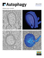 Cover image for Autophagy, Volume 9, Issue 6, 2013