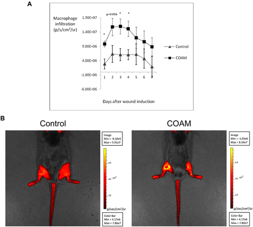 Figure 5 Effect of COAM on monocyte/macrophage infiltration into mouse skin wounds. (A) Macrophage infiltration in the wound area of control and COAM-treated CX3CR1-GFP mice, measured as radiance (p/s/cm2/sr) between day 1 and 7 post-wounding. n=8, *p < 0.05 vs Control group. (B) Illustrations of macrophage infiltration 1 day after wound induction in a control and in a COAM-treated mouse. Induced wounds are located on the left hindlimbs for both mice (dorsal photographs). The higher intensity in the wound of COAM-treated mouse corresponds to more macrophage recruitment.