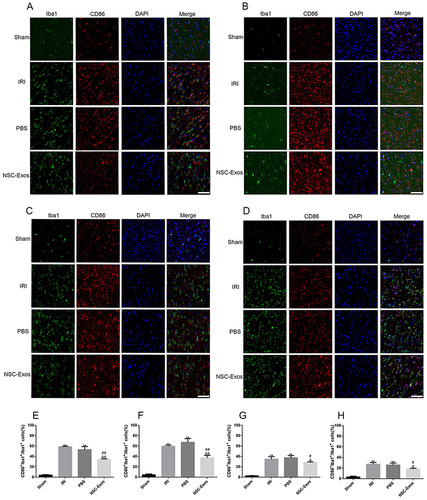 Figure 6 Representative images of parietal cortex co-stained with CD86 and Iba1. (A–D) Representative co-stained images of CD86 and Iba1 on 1d, 3d, 7d, and 14d, green fluorescence indicates Iba1, red fluorescence indicates CD86, and blue fluorescence indicates nuclei. There was almost no co-staining in the sham group. CD86+/Iba1+ cells significantly increased after MCAO, and CD86+/Iba1+ cells gradually decreased after NSC-Exos treatment. NSC-Exos reduced the expression of M1-state markers. (A) At 1d, many CD86 cells appeared. (B) At 3d, CD86 continued to be highly expressed. (C) At 7d, the expression was slightly reduced. (D) At 14d, the expression was lower than that at 7d. (E–H) The proportion of CD86+/Iba1+ in Iba1+ at 1d, 3d, 7d, and 14d in turn. CD86+/Iba1+ was abundantly expressed in the infarcted cortex at 1d and 3d after MCAO, its expression was slightly reduced at 7d and 14d. NSC-Exos treatment decreased the CD86+/Iba1+ cells (**P<0.01 vs Sham group; ##P<0.01, #P<0.05 vs IRI group; &&P<0.01, &P<0.05 vs PBS group, Scale bar=20μm).