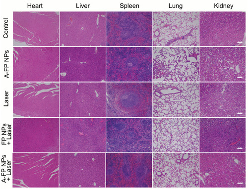 Figure 13 HE staining of the major organs (heart, liver, spleen, lung, and kidney) of MCF-7 tumor-bearing mice after different treatments. The scale bars are 50 μm.Abbreviations: HE, hematoxylin and eosin staining; A-FP NPs, AS1411-PLGA@FePc@PFP; FP NPs, PLGA@FePc@PFP.