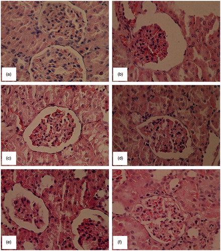 Figure 3. Microscopic structure of kidney of a (a) control rat (group 1) and (b) diabetic rat (group 2) showing sever glomerular distension; (c) PH-treated diabetic rat (group 3) showing only a mild glomerular distension; (d) RC-treated diabetic rat (group 4) showing no pathological condition; (e) UD-treated diabetic rat (group 5) showing only a mild glomerular distension; (f) triplex mixture-treated diabetic rat (group 6) showing no pathological condition. All slides stained with hematoxylin and eosin (original magnification ×10).