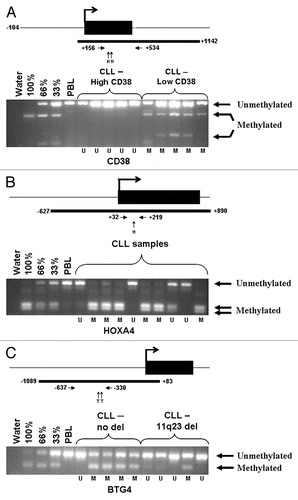 Figure 1 Methylation of the three marker loci in CLL samples. Examples of methylation analysis using COBRA assays for (A) CD38, (B) HOXA4 and (C) BTG4. Above each is a diagram of the locus analyzed indicating the position of the first exon and start of transcription (large arrow), the position of the CpG island (thick black line), the positions of the primers used (small horizontal arrows) and the positions of the restriction enzymes for the digest used in each example (small vertical arrows; H, HinFI and T, TaqI). The positions of bands representing methylated and unmethylated DNA are indicated by arrows and the controls used are indicated above their respective lanes [no DNA (water), 100, 66 and 33% (in vitro methylated DNA), diluted into PBL (peripheral blood leukocytes) DNA as required and PBL]. Under each sample lane an M or U indicates if the sample was considered methylated (M) or unmethylated (U) for the purposes of the subsequent analysis. In (A) samples were either high (>30%) or low (<30%) for CD38 expression. In (C) samples were either positive (11q23 del) or negative (no del) for the 11q23 deletion. Primers used were as previously described for HOXA4,Citation10 Forward 5′-GGT GTT AAG GTT AGT TGT TTT TGA AAG, Reverse 5′-ACT CTC TAA AAA AAC CCA ACT CTA TC for CD38 and Forward 5′-GTT TGG TAT TTT TGG GGG TTA TGG, Reverse 5′-CAA TAC AAT CAA CTA ATA ACA CTA CCT AC for BTG4.
