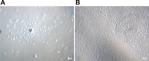 Figure 1 Morphological changes in mouse bone marrow-derived MNCs. A) Cells changed from globe-like shape to being thin and flat, and then round and fusiform at day 4 (magnification ×100). B) At days 7–10, the cells exhibited a typical long fusiform or “cobblestone” morphology (magnification ×100).Abbreviation: MNCs, mononuclear cells.