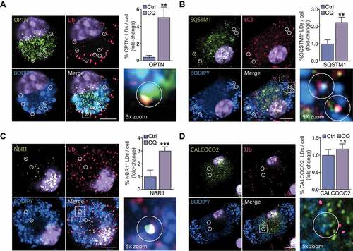 Figure 4. Selective autophagy receptors (SARs) OPTN, NBR1 and SQSTM1 selectively localize to foam cell lipid droplets (LDs). (A-D) Immunostaining for OPTN (A), SQSTM1 (B), NBR1 (C) or CALCOCO2 (D) in agLDL-loaded mouse bone marrow-derived macrophage foam cells stained with BODIPY 493/503 to label LD neutral lipids, with areas of interest circled. At right, quantification of the percent of cellular LDs tagged with SARs in chloroquine-treated cells (CQ) as compared to control (Ctrl) is shown. Data are expressed as fold-change for the chloroquine treatment relative to untreated from one experiment representative of 3 independent experiments with similar results (mean ± s.e.m). **P< 0.005, ***P< 0.0005. Representative images are from CQ-treated cells. Scale bar: 5 μm