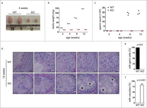 Figure 2. Germ cells are completely lost in small testes from Chfr knockout male mice at 12 weeks. (a) Typical pictures of normal testes from WT male mice and small testes from Chfr knockout male mice are shown. (b) The weight of normal testes from WT male mice and small testes from Chfr knockout male mice are shown. (c) Sperm were harvested from epididymides of mice shown in (b), and sperm counts are shown. (d) Testis sections of 12-week-old WT and Chfr knockout male mice were stained with periodic acid schiff (PAS)-hematoxylin. Typical pictures are shown. Scale bar, 50 µM. Asterisk: large vacuoles. (e-f) Seminiferous tubules with germ cells (e) and with large vacuoles (f) are summarized. Mean and standard deviation are shown.