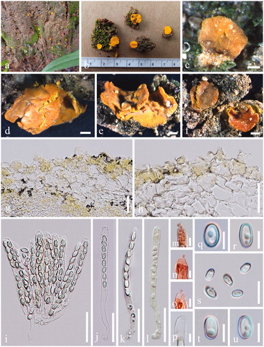 Figure 3. Acervus globulosus (MFLU 20-0258). (a–f) Typical mature specimens. (g, h) Receptacle surface of pileus. (i) Asci and paraphyses. (j–l) Asci (l Asci in Melzer’s reagent.). (m–p) Apexes of asci (m–o Apexes in Congo red.). (q–u) Ascospores. Scale bars: c = 1500 μm. d–f = 1000 μm. g–l = 30 μm. m–u = 5 μm.