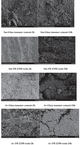 Figure 1. Electron microscopy pictures of biofilms on different dental materials.