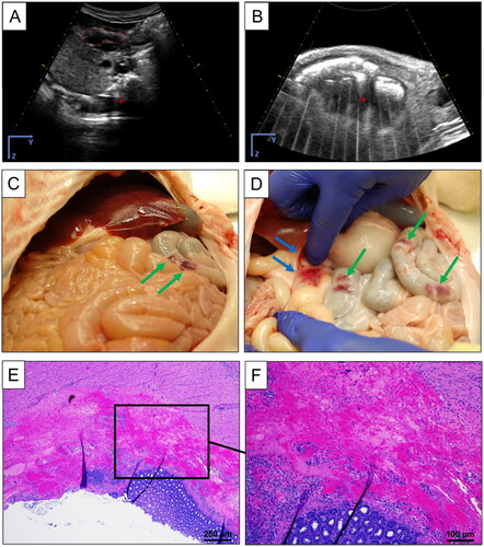 Figure 3. Histotripsy Treatment - Fasted Acute Pigs. Freehand US imaging of pancreas body indicated by red dashed lines in a fasted pig (A). US imaging with standoff showing gas obstruction prior to histotripsy treatment (B). Intestinal gas interference with treatment prevented ideal imaging quality and bubble formation during treatment leading to pre-focal intestinal bruising (C-D) more highly concentrated in the more gaseous large intestine, indicated by the green arrow, and small intestine, indicated by the blue arrows. Post-treatment H&E histopathology indicated that from a sample of the bruised colon, the muscularis was not damaged but there was a large amount of ablation and hemorrhage within the submucosa (E-F).
