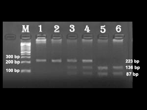 Figure 1. PCR-RFLP products of ICAM-1 gene E469K polymorphism obtained by 3% agarose gel electrophoresis.
