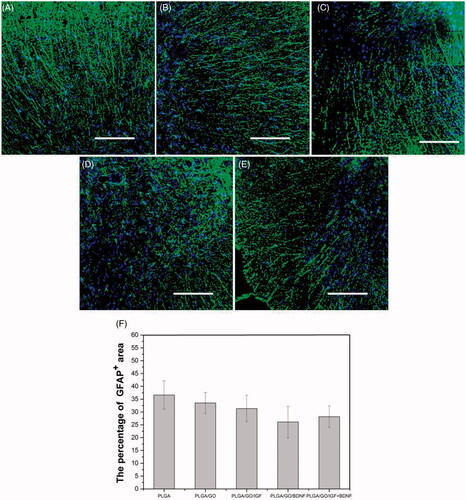 Figure 12. Qualitative and quantitative evaluation of astrocytes in the injury site after SCI. Immunocytochemical staining of astrocytes on pure PLGA nanofibers (A), PLGA/GO nanofibers (B), PLGA/GO/IGF nanofibers (C), PLGA/GO/BDNF nanofibers (D) and PLGA/GO/IGF + BDNF nanofibers (E). Immunostaining makers are GFAP for astrocytes and DAPI for nuclei. The Scale bar was 200 µm. (F) The percentage of GFAP positive area per visual field.