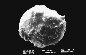 3 Scanning electron photomicrograph of coated cross-linked chitosan microspheres.