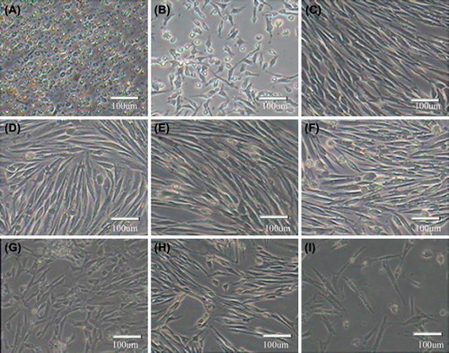 Figure 1. Morphology of in vitro cultured skeletal muscle satellite cells A. Satellite cells before adhere were round, refract sexual strong; B. Adherent cells were spindle-shaped or fusoid; C. With the increase of the cell density, cells become regularly arranged in parallel; D–I. Chicken satellite cells, passage 2 (D), passage 4 (E), passage 6 (F), passage 8 (G), passage 10 (H) and passage 12 (I).
