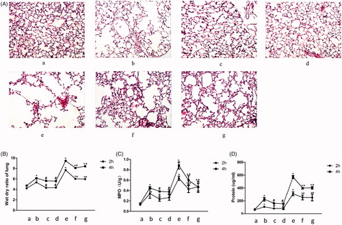 Figure 4. Knockdown of NLRP3 or TRPM2 alleviated the ventilator-induced lung injury. Histological changes of lung tissue stained by HE, infiltration of inflammatory cells were marked with black arrows (A); Measurement of the wet-dry ratio of lung in VILI models (B); Measurement of MPO in VILI models (C); Measurement of BALF protein in VILI models (D). a: WT C57BL/6 mice treated with sham operation; b: WT C57BL/6 mice treated with normal tidal volume ventilation; c: TRPM2-/- mice treated with normal tidal volume ventilation; d: NLRP3-/- mice treated with normal tidal volume ventilation; e: WT C57BL/6 mice treated with high tidal volume ventilation; f: TRPM2-/- mice treated with high tidal volume ventilation; g: NLRP3-/- mice treated with high tidal volume ventilation. *p<.05 vs. control; #p<.05 vs. normal tidal volume ventilation; +p<.05 vs. high tidal volume ventilation.