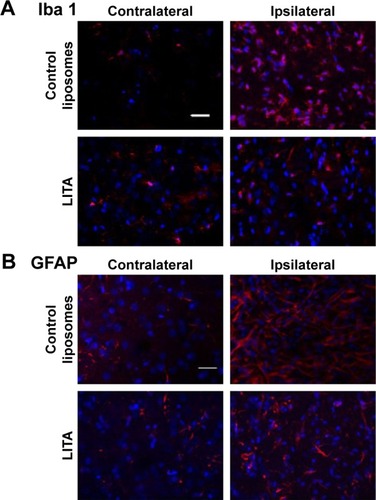 Figure 4 Immunofluorescence micrographs of (A) Iba 1 and (B) GFAP immunoreactivities in the peri-infarct area (ipsilateral to the stroke lesion) and the corresponding region in the contralateral hemisphere in control or liposomal encapsulated acetate (LITA)-treated animals at 2 weeks after middle-cerebral artery occlusion (scale bar: 50 µm).