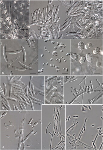 Figure 3. Neocosmospora and Fusarium clinical species. (A–C) N. solani: conidiophores, macro- and microconidia, and chlamydospores, respectively. (D–F) N. keratinoplastica: macro, microconidia, and chlamydospores, respectively. (G,H) N. falciformis: macroconidia and chlamydospores, respectively. (I) F. oxysporum: monophialides producing microconidia. (J) F. fujikuroi: Mono-, polyphialides, and microconidia. (K,L) F. verticillioides: monophialides producing conidia in chains. Scale bars: (A–L) = 10 µm.