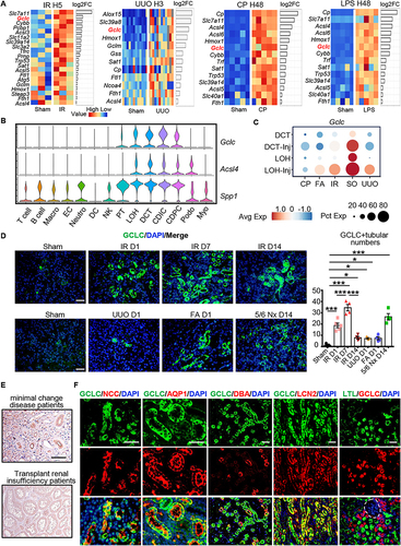 Figure 3 GCLC expression was upregulated in various kidney injury models. (A) Transcriptome heatmaps related to renal ferroptosis at IR H5, UUO H3, CP H48, and LPS H48. (B) Vlnplot of Gclc, Acsl4, and Spp1 in different cell subtypes. (C) Dotplot of Gclc in different subtypes of distal nephron. (D) Immunofluorescence and scoring of GCLC in IR D1, IR D7, IR D14, UUO D1, FA D1, and 5/6 Nx D14 (n = 4–5 per group). (E) Immunohistochemical staining of GCLC in minimal change disease patients and transplant renal insufficiency patients. (F) Immunofluorescence co-staining of GCLC with distal convoluted tubule marker NCC, loop of Henle marker AQP1, collecting duct marker DBA, injury distal tubule marker LCN2, and proximal tubule marker LTL, respectively. Site marked by white dotted lines was glomeruli. *P < 0.05, ***P < 0.001 as determined by one-way ANOVA. Scale bar, 20 μm. Data represent mean ± SEM.